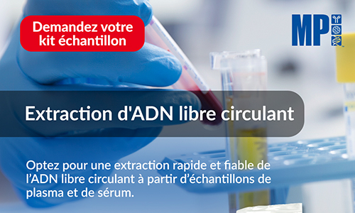 Nouveauté produit laboratoire : FastSPINeasy cfDNA Kits - Des résultats fiables à chaque extraction