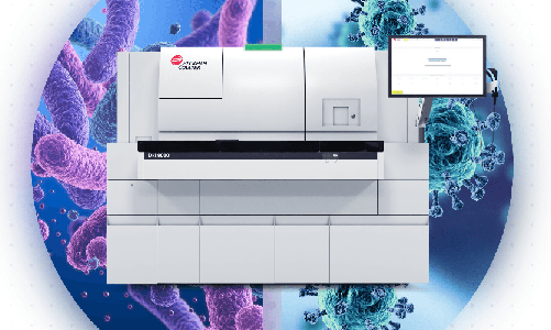 Beckman Coulter Diagnostics obtient le marquage CE pour un nouveau test permettant de différencier les infections bactériennes et virales en environ 20 minutes